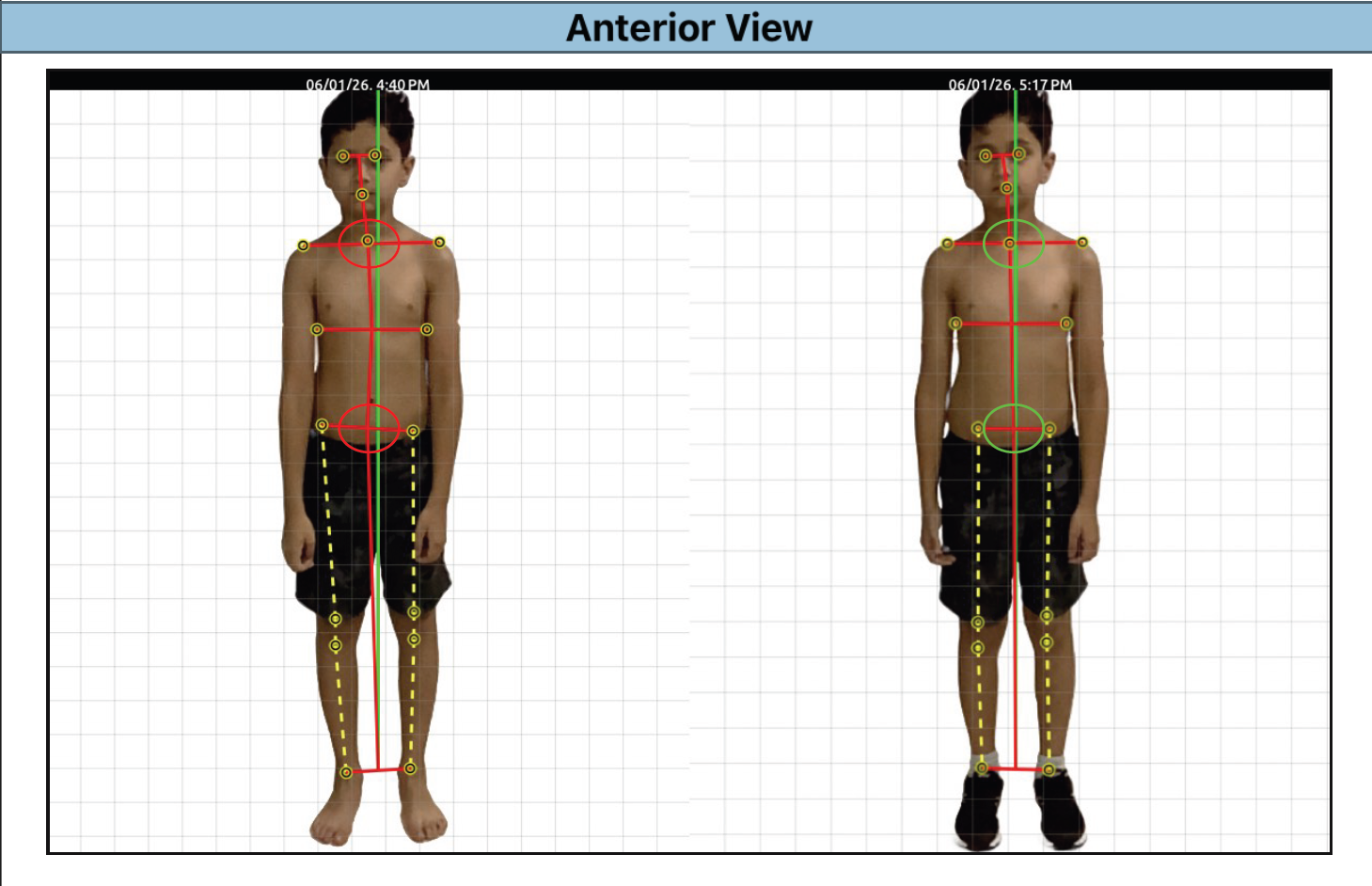 Anterior View